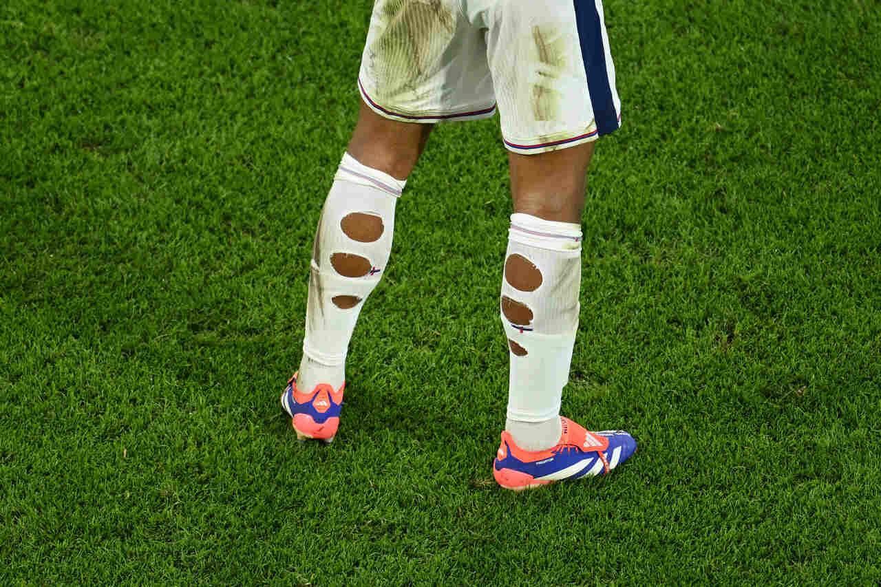 Por que alguns jogadores usam meião furado? O motivo real por trás da moda